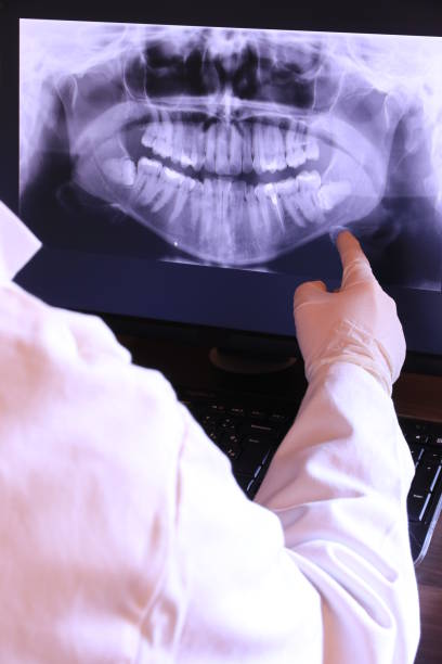 Best Emergency Dentist for Lost Fillings or Crowns in Minneola, FL